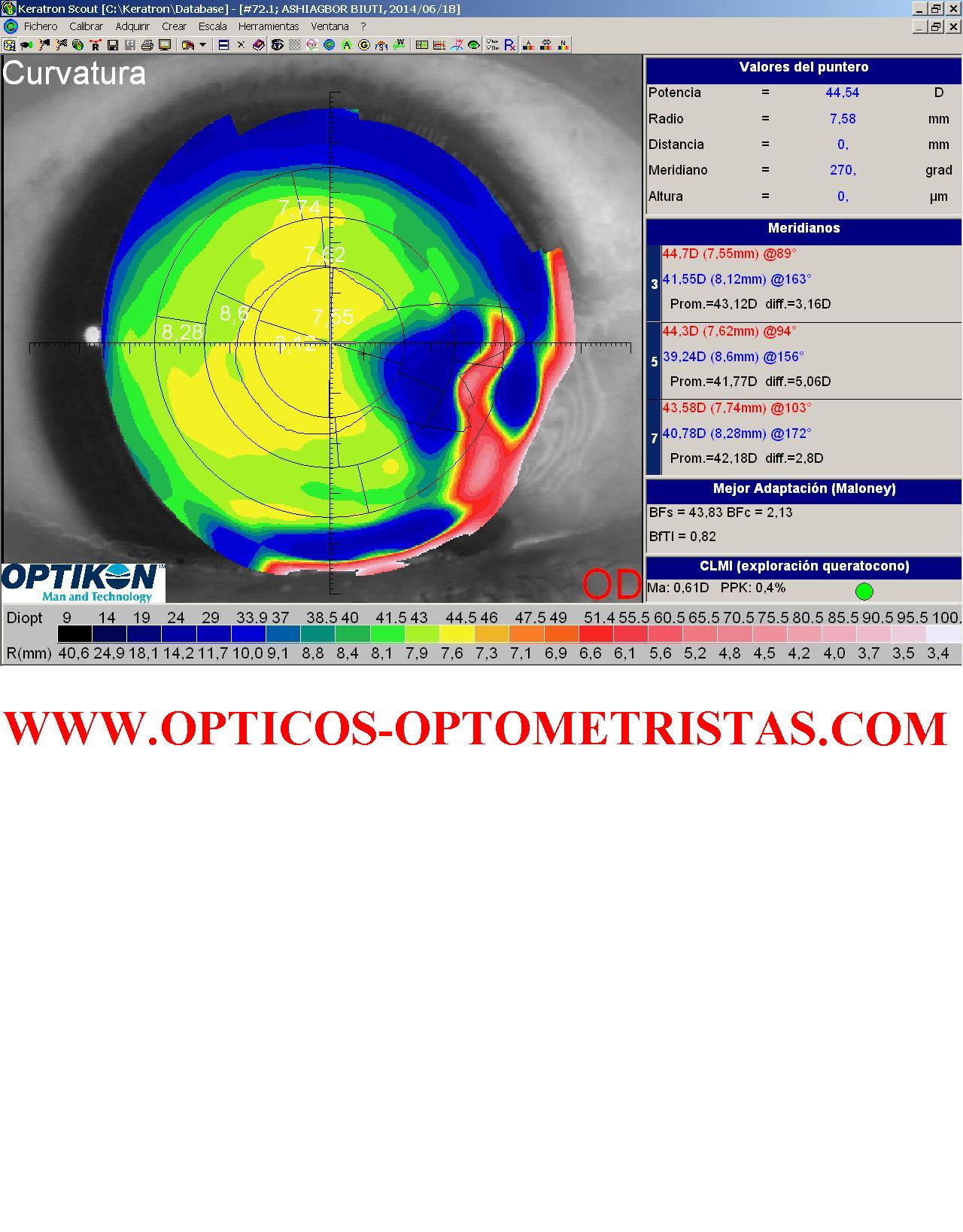 Imagen
