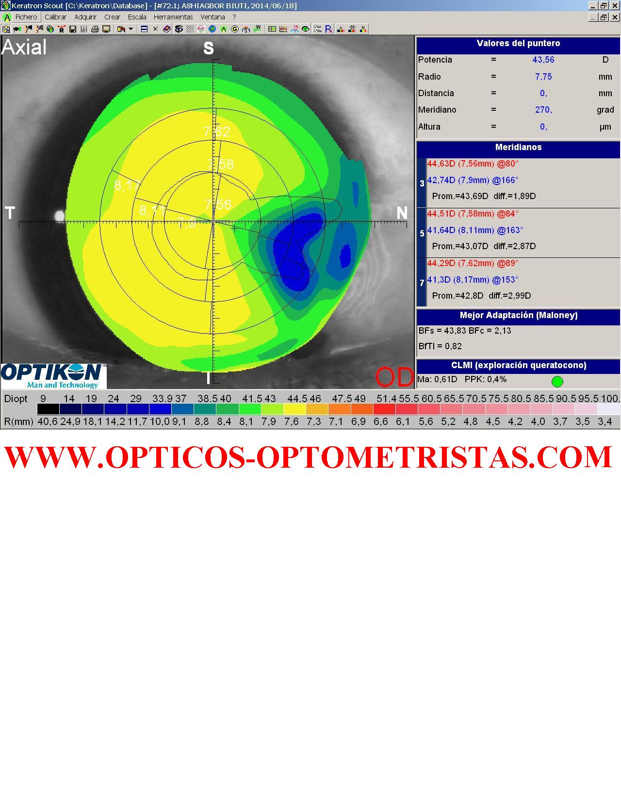 Imagen